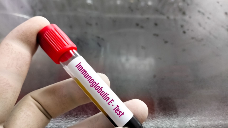 Định lượng IgE trong chẩn đoán dị ứng giúp phát hiện và đánh giá các phản ứng dị ứng của cơ thể