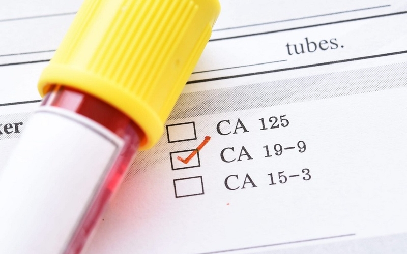 Vai trò của xét nghiệm CA 19-9 và ý nghĩa trong chẩn đoán ung thư tụy. 3