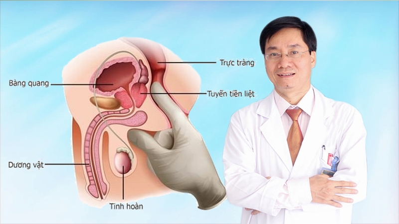 Vai trò tuyến tiền liệt đối với sức khỏe là gì?