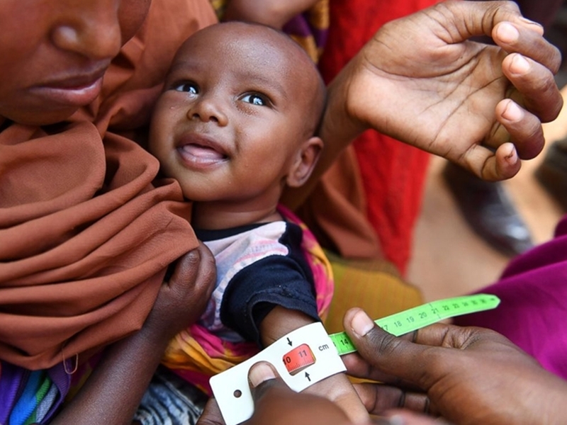 vấn đề suy dinh dưỡng ở trẻ em 01