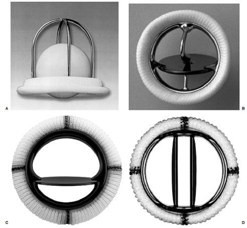 Van tim nhân tạo là gì? Cách chọn van tim nhân tạo phù hợp nhất 2