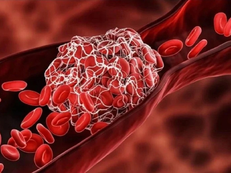 Van tĩnh mạch là gì? Triệu chứng cảnh báo van tĩnh mạch bị hỏng 1