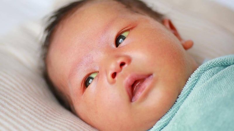 Vàng da lòng bàn tay có phải mắc bệnh không 2