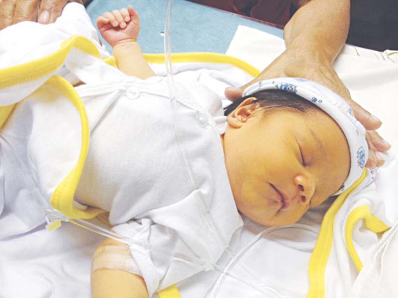 vàng da sơ sinh là gì