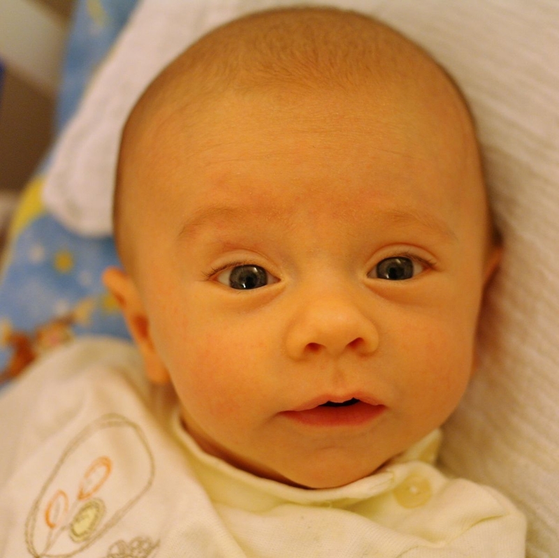 Vàng mắt ở trẻ sơ sinh bao lâu thì hết?2