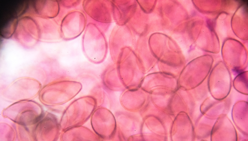 Vật chủ là gì? Danh sách những căn bệnh phổ biến do ký sinh trùng gây ra 5