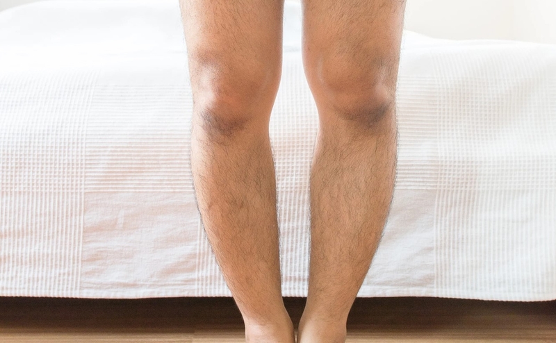 Vật lý trị liệu chân vòng kiềng người lớn và những điều bạn cần biết 1