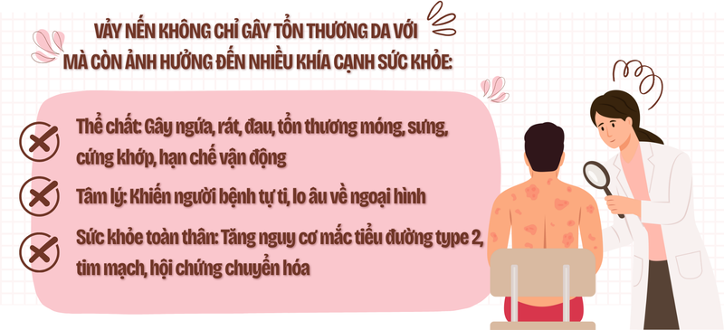 Vảy nến không chỉ là bệnh ngoài da: Đừng bỏ qua những tổn thương bên trong cơ thể! 7
