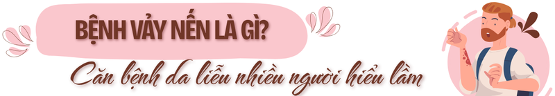 Vảy nến không chỉ là bệnh ngoài da: Đừng bỏ qua những tổn thương bên trong cơ thể! 1
