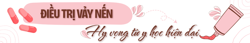 Vảy nến không chỉ là bệnh ngoài da: Đừng bỏ qua những tổn thương bên trong cơ thể! 8