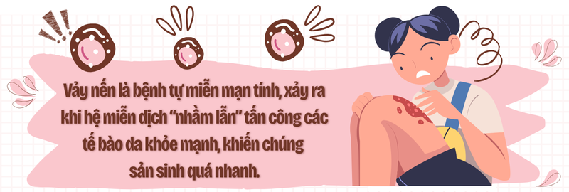 Vảy nến không chỉ là bệnh ngoài da: Đừng bỏ qua những tổn thương bên trong cơ thể! 2