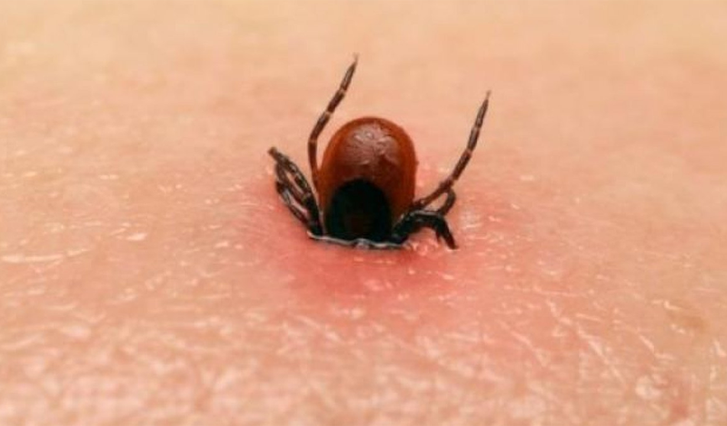 Ngứa da khi bị ve chó cắn