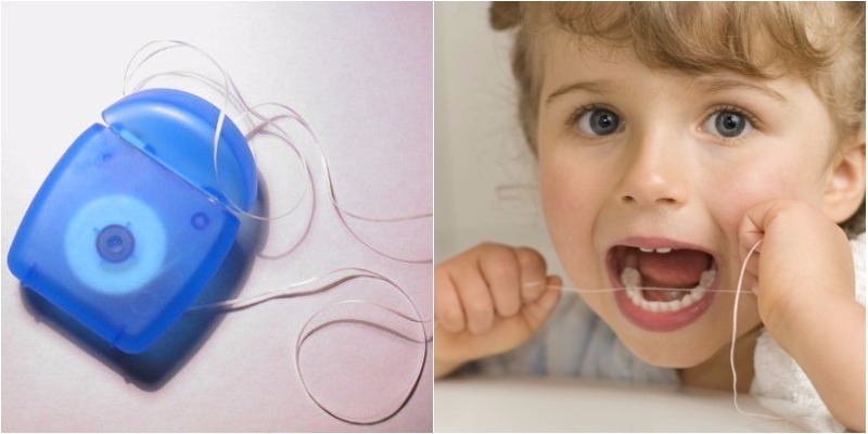 Khi nào trẻ nên dùng chỉ nha khoa