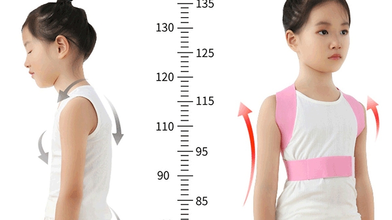 Vẹo cột sống ở trẻ cần điều trị như thế nào để không ảnh hưởng sức khoẻ 3