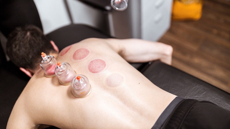 Vì sao có vết bầm tím khi giác hơi? Có ảnh hưởng đến sức khỏe không 2