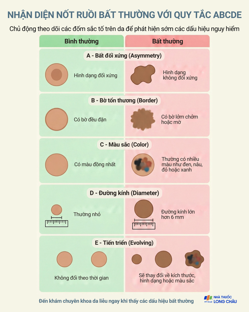 Để phát hiện sớm ung thư tế bào hắc tố, chuyên gia da liễu khuyến cáo cần áp dụng quy tắc ABCDE