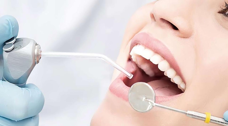 Vết đen trên răng hàm là do những nguyên nhân gì? 4