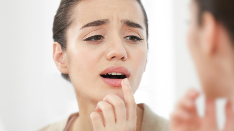 Vết loét nhiệt miệng có lây không? Cách phòng ngừa 4