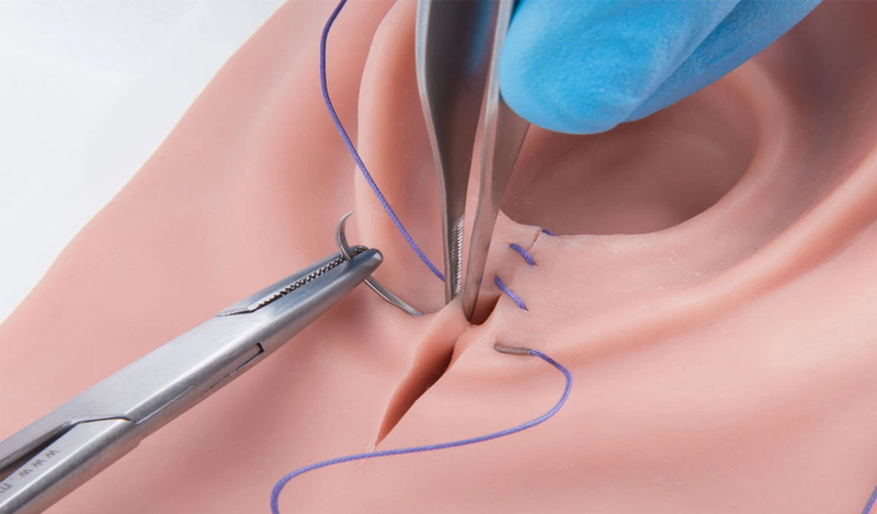 Giải đáp thắc mắc: Nguyên nhân vết rạch tầng sinh môn bị nhức?1