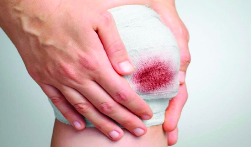 Vết thương hở ăn rong biển được không? 1