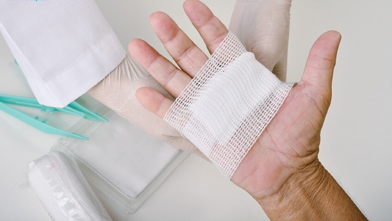 Vết thương mạch máu: Nguyên nhân và cách sơ cứu bạn cần biết 1