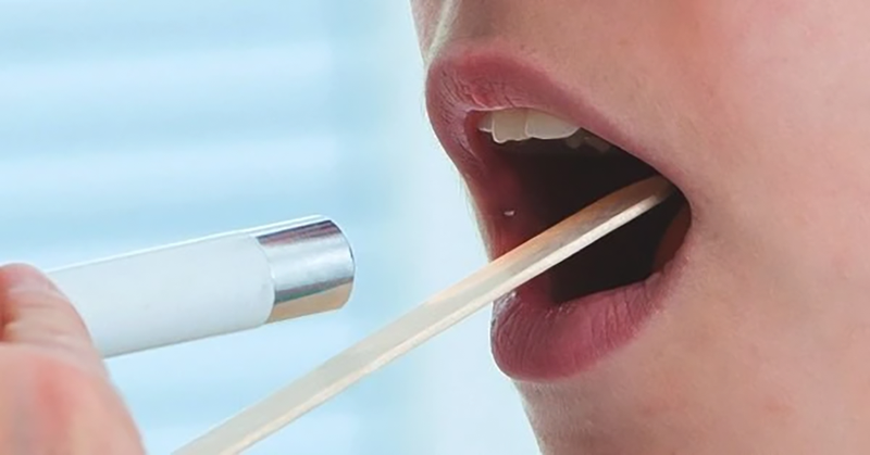 Vị giác có mùi máu nguyên nhân do đâu? 2