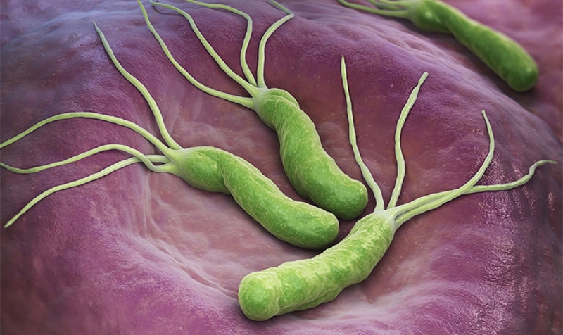 Chữa vi khuẩn HP bằng nghệ có hiệu quả không? 1