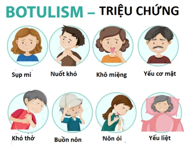 Vi khuẩn botulinum là gì? Nguồn gốc, triệu chứng và cách phòng ngừa 3