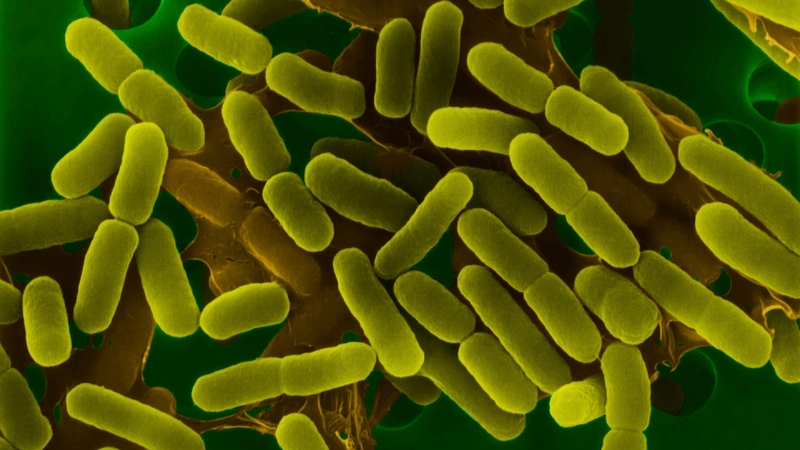 vi khuẩn gram âm 1