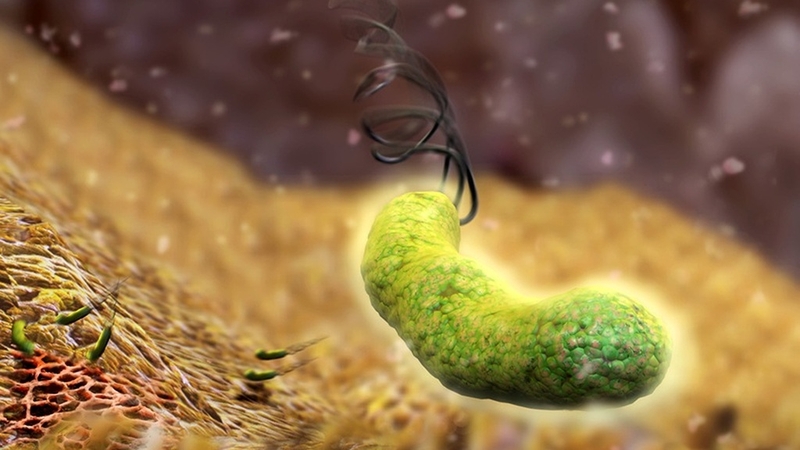 Vi khuẩn H.P gây bệnh tiêu hóa gì và lây qua đường nào? 3