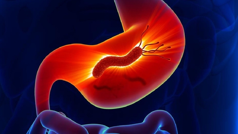 Vi khuẩn HP có tự hết không? Điều trị HP bao lâu thì hết? 4