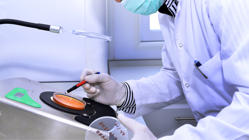 Xét nghiệm AFB là phương pháp dùng để phát hiện sự hiện diện của vi khuẩn kháng acid
