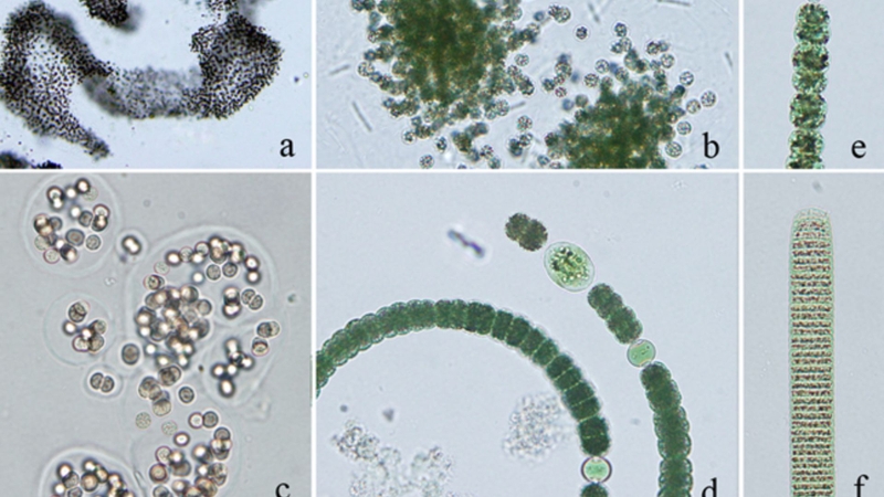 Vi khuẩn Lam - Hiểu rõ triệu chứng, con đường lây lan và cách phòng tránh 2