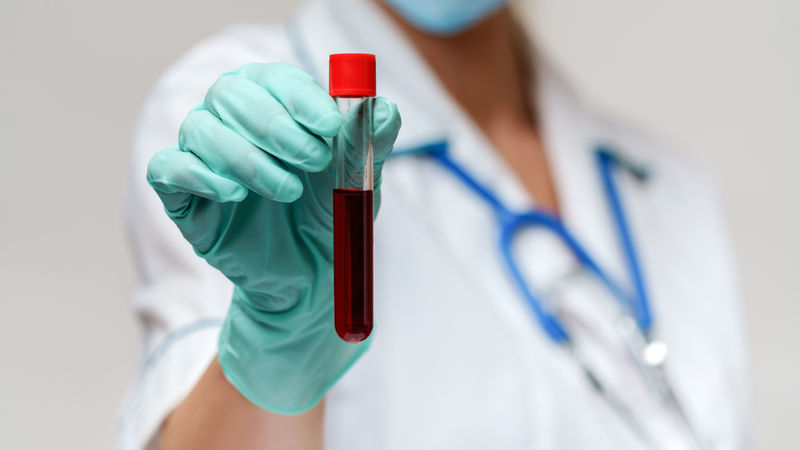 Kết quả xét nghiệm giúp đánh giá mức độ thay đổi của lipid máu