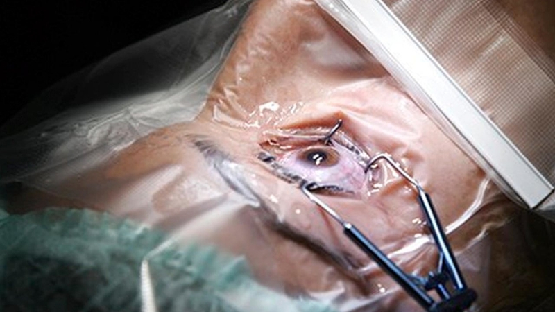 Vì sao bị chói mắt và cách khắc phục? 2