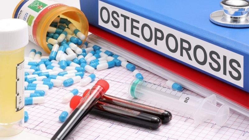 Vì sao có tình trạng loãng xương do thuốc 1