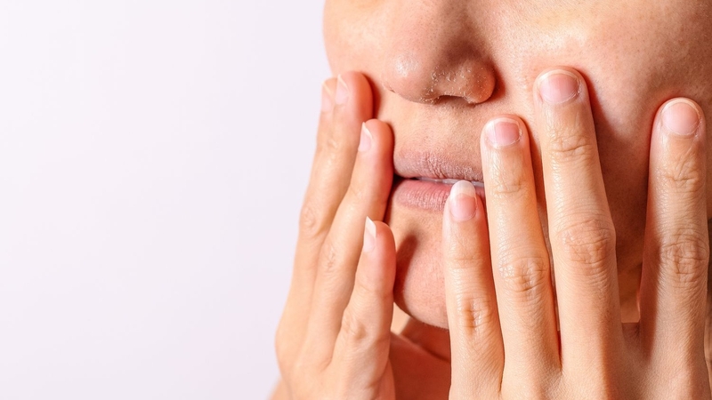 Vì sao đắp mặt nạ bột diếp cá bị ngứa? Cách xử lý hiệu quả 2