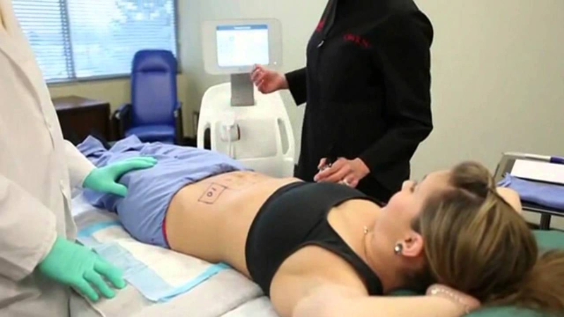 Vì sao hút mỡ có thể gây tử vong? 2