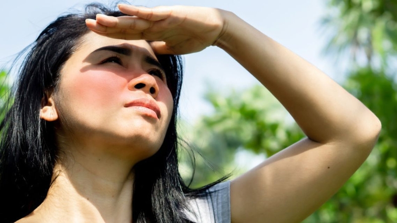 Không phải ai cũng biết vì sao lupus cần tránh ánh nắng