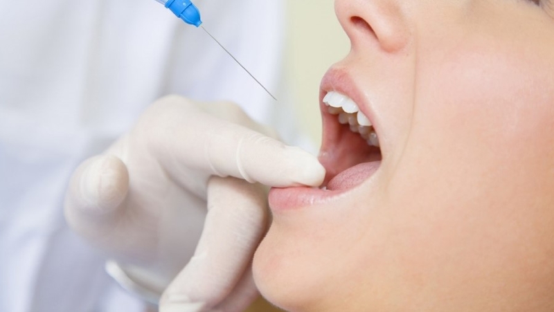 Vì sao phải lấy tủy răng? Lấy tủy răng có đau không? 3