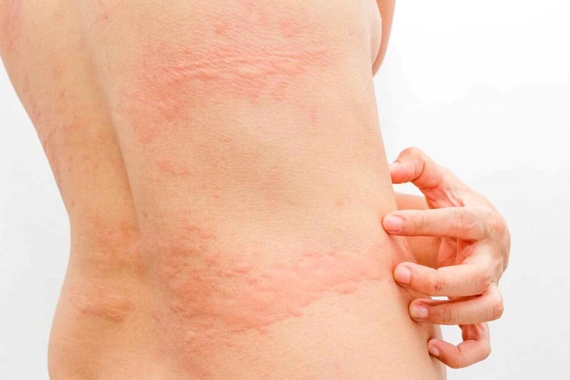 Vì sao sử dụng máy massage bụng bị ngứa? 3