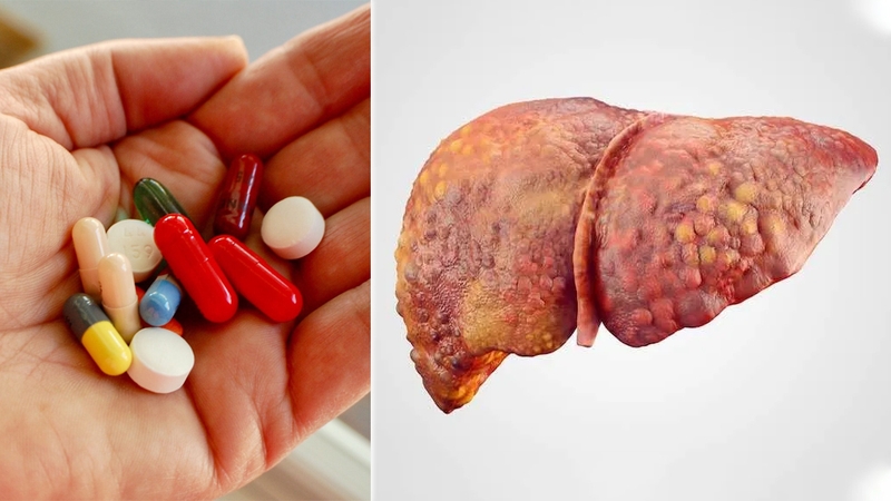 Vì sao uống thuốc giải độc gan bị ngứa và cách khắc phục 5