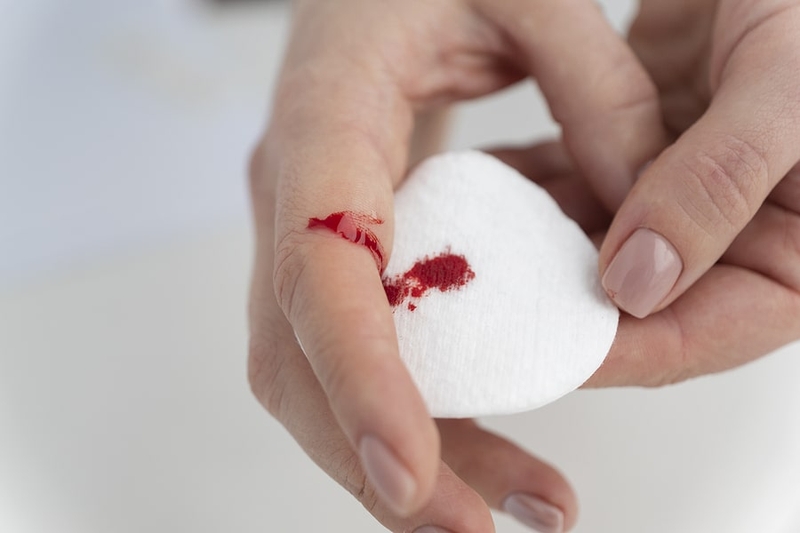 Vì sao vết thương chảy máu không ngừng và cách sơ cứu khi bị thương 4