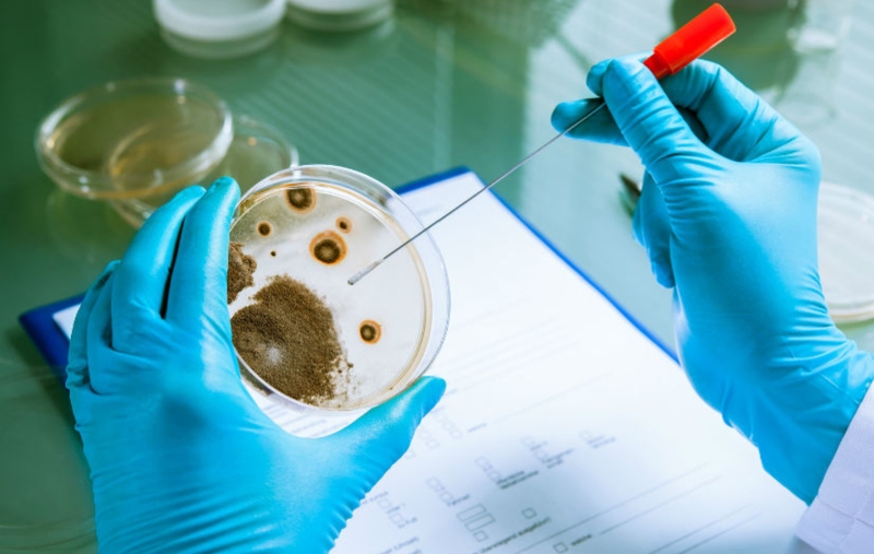 Vi sinh vật hiếu khí có ý nghĩa và vai trò gì trong hệ sinh thái và sức khỏe con người? 3