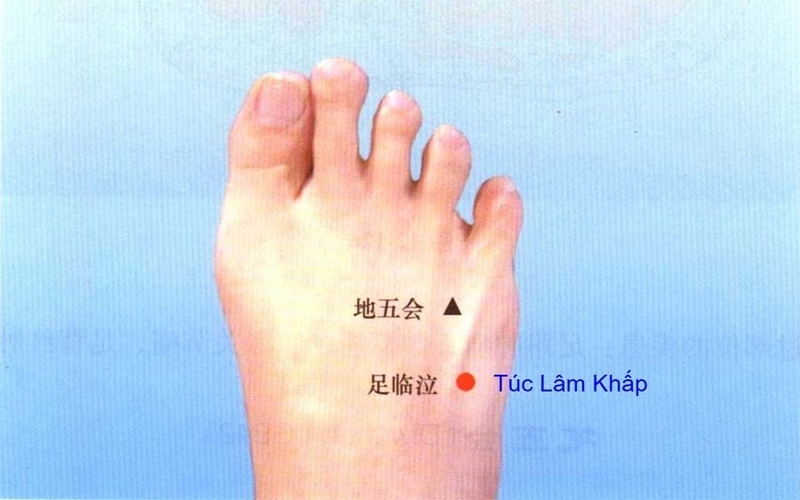 vi-tri-cua-huyet-tuc-lam-khap-o-dau-tren-co-the 1.jpg