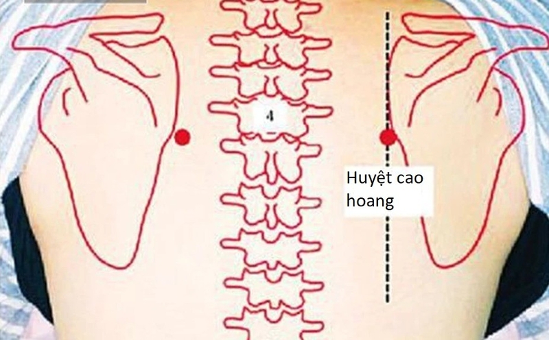 Vị trí huyệt Cao Hoang nằm ở đâu? Bài tập thể dục cho huyệt Cao Hoang
