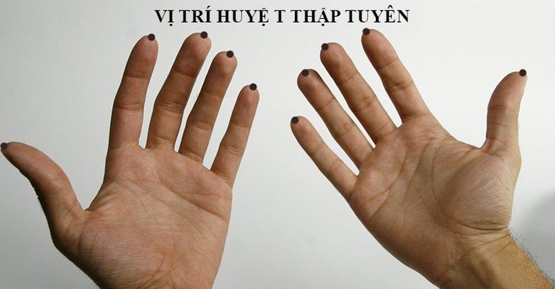 Vị trí huyệt Thập Tuyên và cách tác động lên huyệt đúng cách1