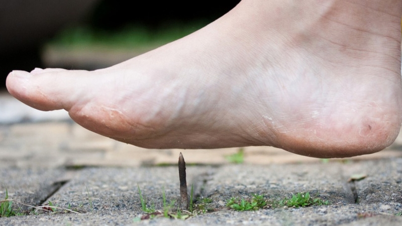 Việc tiêm vắc xin ngừa uốn ván quan trọng như thế nào? 3