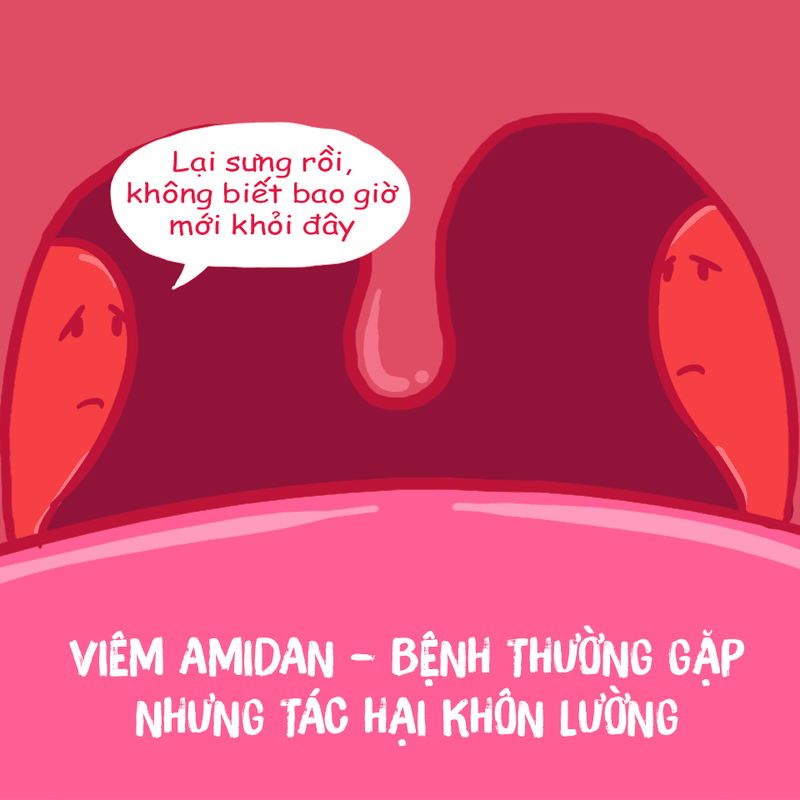 Viêm amidan cấp ở trẻ em: Triệu chứng, cách điều trị và cách phòng chống 1