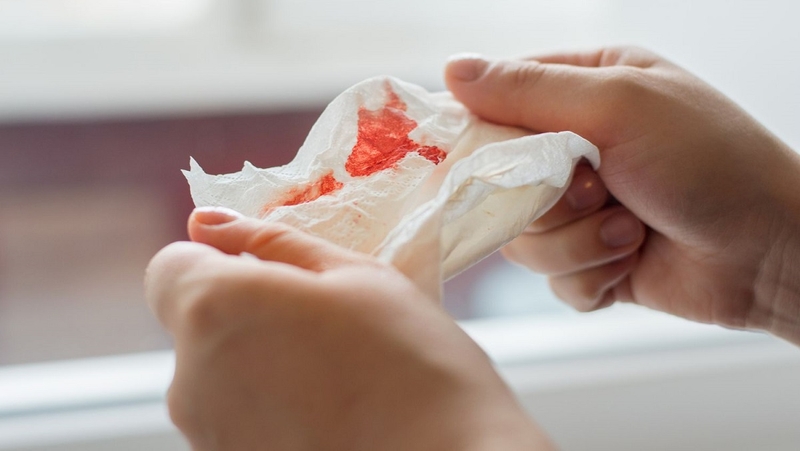 Viêm amidan khạc ra máu có nguy hiểm không? Xử trí như thế nào? 1